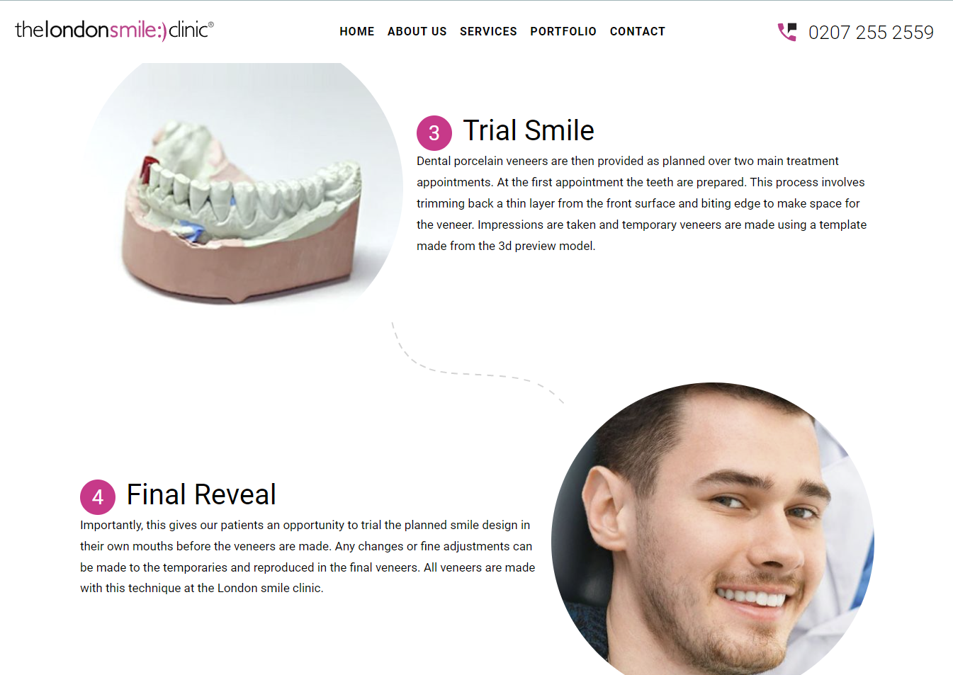 Screenshot of information on the London Smile Clinic website